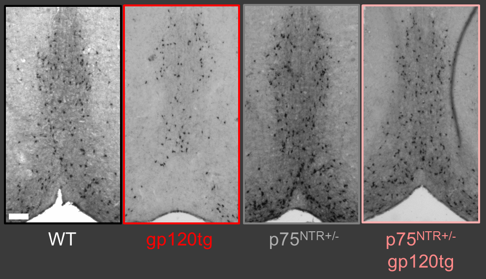 Visualizing intranuclear interactions of a neuronal DNA methyltransferase and a histone lysine methyltransferase in models of Huntington's disease.