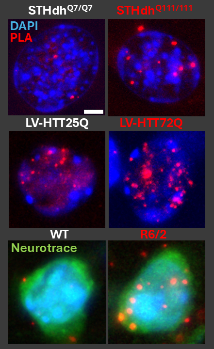 Visualizing intranuclear interactions of a neuronal DNA methyltransferase and a histone lysine methyltransferase in models of Huntington's disease.
